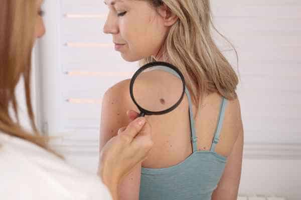 What Are Traditional Skin Lesion Removal Methods Haverhill?