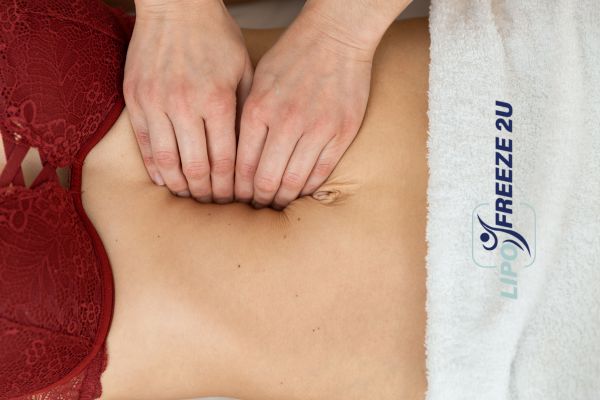 diastasis recti treatment Haverhill