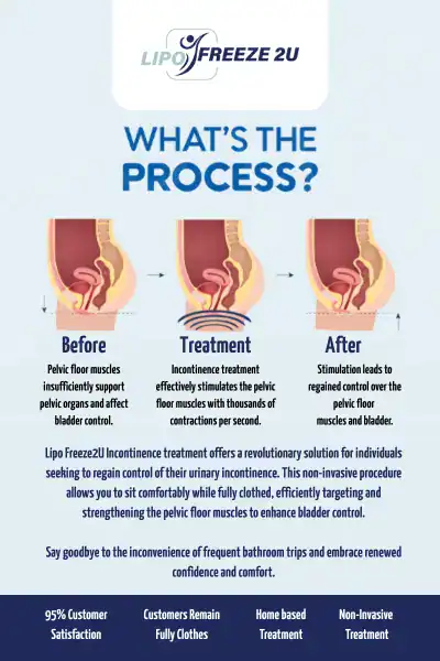 Diagram of how incontinence treatment Haverhill works.