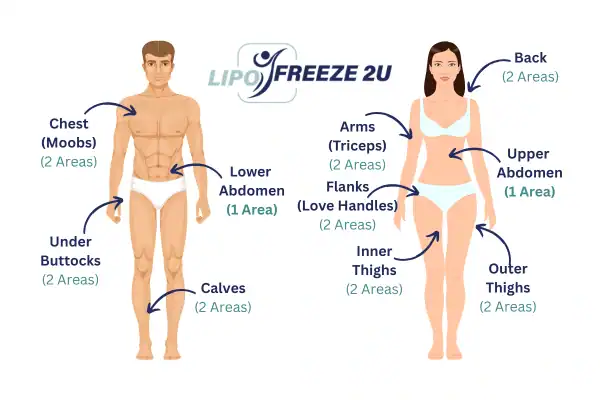 Areas you can have fat freezing treatment Haverhill