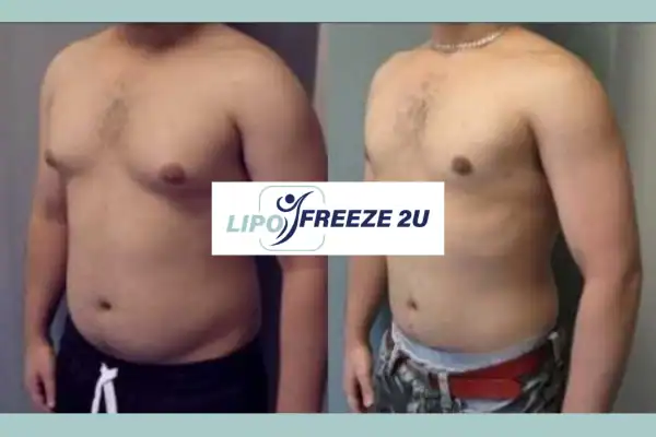 How Long Does It Take to See Results Haverhill?
