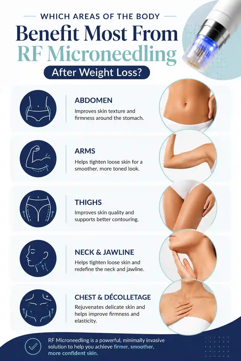 Which Areas of the Body Benefit Most From RF Microneedling After Weight Loss Haverhill
